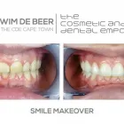 Maatskappy 5 beeld CAPE TOWN DENTIST Dentistry in Cape Town WC