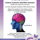 Maatskappy 1 beeld CORE BRAIN DEVELOPMENT Educational Aids in Port Elizabeth EC