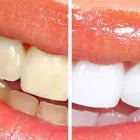 Business 1 image DENTIST DR EMIL JANSEN Teeth Whitening in Centurion GP