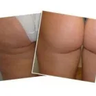 Maatskappy 5 beeld MIRACULOUS MEDICAL SLIMMING Weight Loss and Slimming in Pretoria in Pretoria North GP