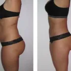 Maatskappy 6 beeld MIRACULOUS MEDICAL SLIMMING Weight Loss and Slimming in Pretoria in Pretoria North GP