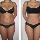 Maatskappy 7 beeld MIRACULOUS MEDICAL SLIMMING Weight Loss and Slimming in Pretoria in Pretoria North GP