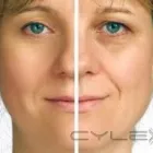 Maatskappy 2 beeld MYSLIM - NON-SURGICAL ULTRASOUND LIPOSUCTION Ultrasound Liposuction in Roodepoort GP