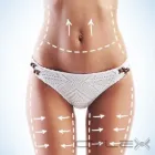 Maatskappy 6 beeld MYSLIM - NON-SURGICAL ULTRASOUND LIPOSUCTION Ultrasound Liposuction in Roodepoort GP