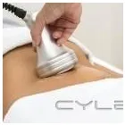 Maatskappy 15 beeld MYSLIM - NON-SURGICAL ULTRASOUND LIPOSUCTION Ultrasound Liposuction in Roodepoort GP