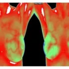 Maatskappy 4 beeld THERMAL HEALTH CENTRE PTA EAST Thermography in Pretoria GP