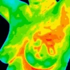 Maatskappy 5 beeld THERMAL HEALTH CENTRE PTA EAST Thermography in Pretoria GP