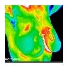 Maatskappy 6 beeld THERMAL HEALTH CENTRE PTA EAST Thermography in Pretoria GP