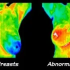 Maatskappy 10 beeld THERMAL HEALTH CENTRE PTA EAST Thermography in Pretoria GP