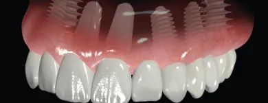 Business 6 image DENTIST DR EMIL JANSEN Teeth Whitening in Centurion GP